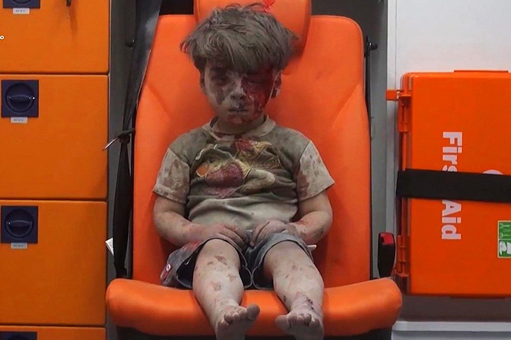 Omran Daqneesh kanak-kanak Berusia lima tahun duduk dalam ambulans selepas ditarik keluar daripada sesebuah bangunan dilanda serangan udara di Aleppo, Syria - AP