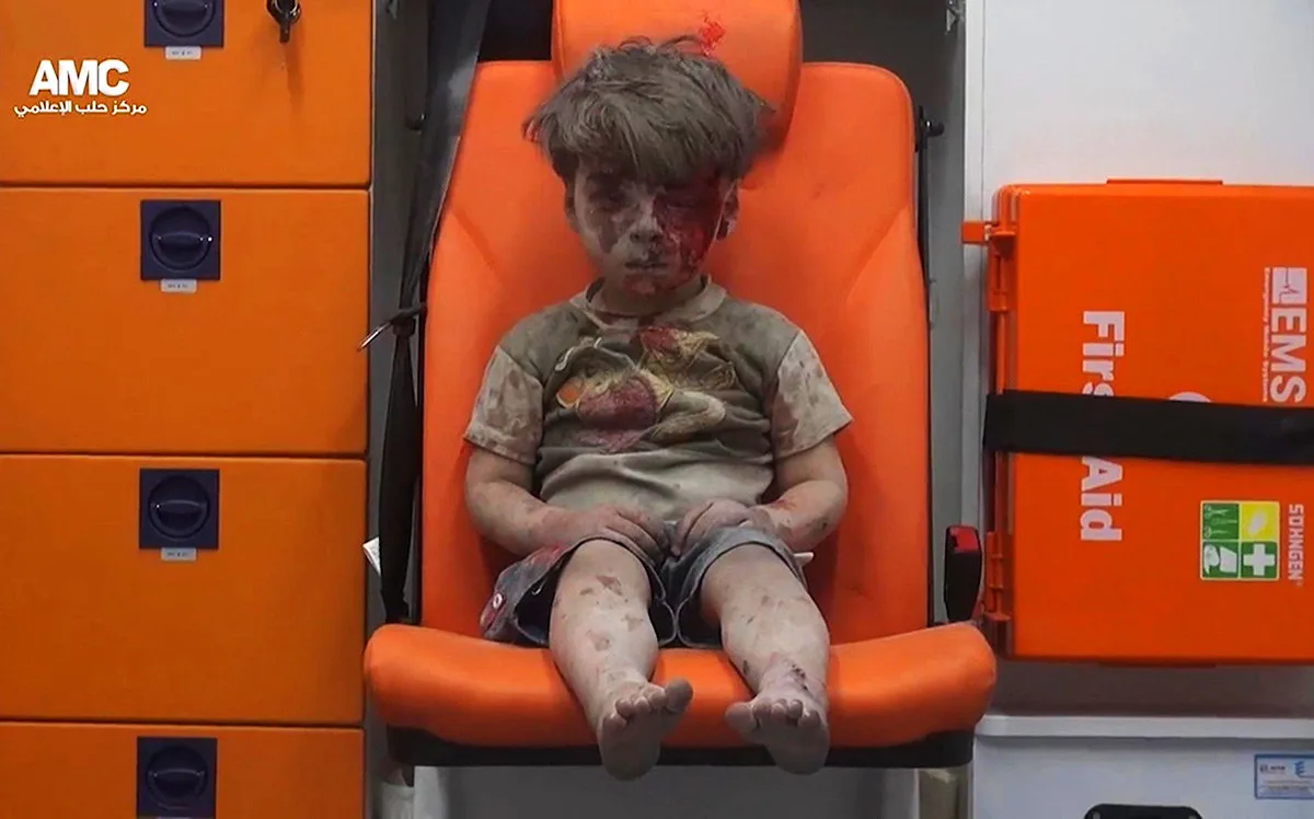 Omran Daqneesh kanak-kanak Berusia lima tahun duduk dalam ambulans selepas ditarik keluar daripada sesebuah bangunan dilanda serangan udara di Aleppo, Syria - AP