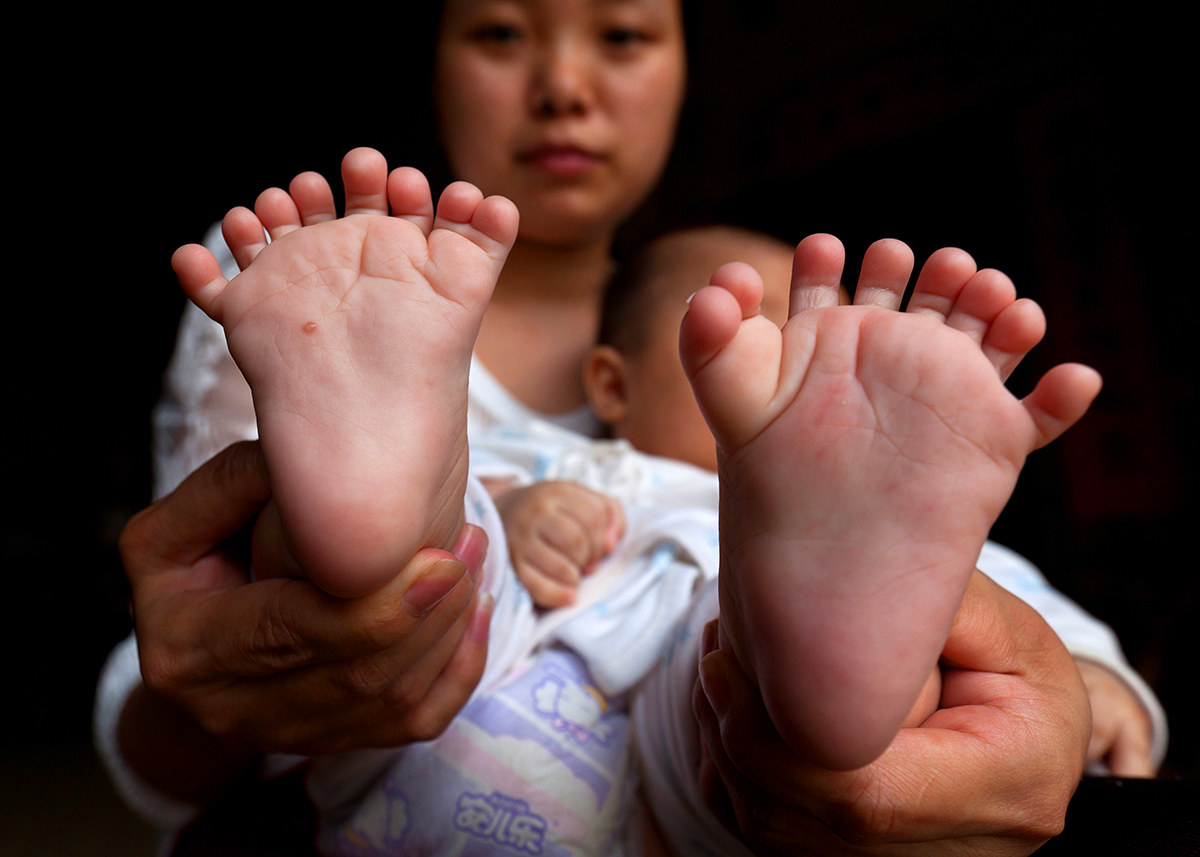 Ibu bersama bayinya yang memiliki 8 jari pada kakinya.- Getty Images