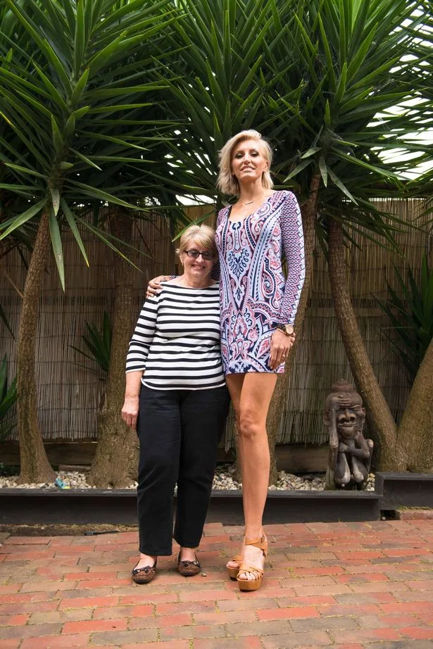 ex-model-bids-for-worlds-longest-legs-4
