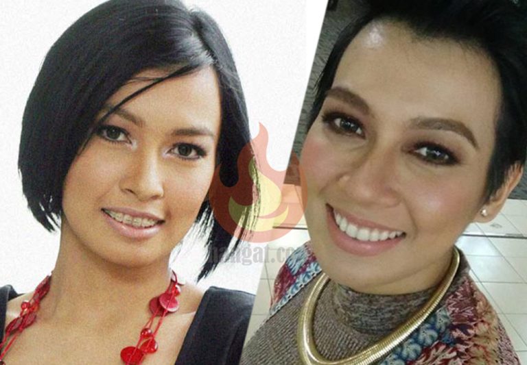 Selepas Braces, 5 Artis Popular Ini Miliki Deretan Gigi ...