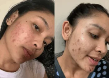 Foto - Instagram @sissyimann