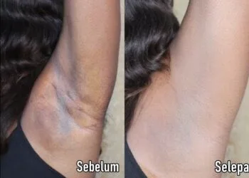 Foto - The Guardian Nigeria