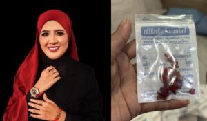 Isteri Azlan Komen, Nur Nilam Ortiz Buang Silikon Hidung! Berhasrat Buang Tatu Pada Masa Akan Datang