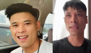 Jatuh Secara Tiba-Tiba, Andi Bernadee Dedah Sedang Dalam Proses Kuatkan Kaki