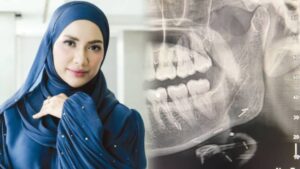 Doktor Pasang Zikir Lepas Nampak X-Ray Zara Zya, Disangka Pakai Susuk!