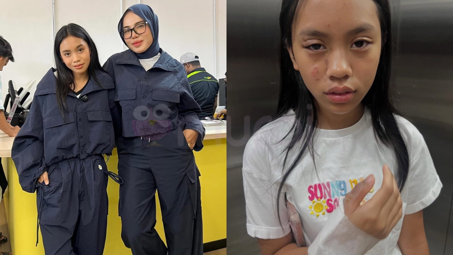 Watie Hanifiah Menggeletar Lihat Thalita Melecur Kerana Minyak Panas-“Mulut Dia Tak Henti Tanya…”