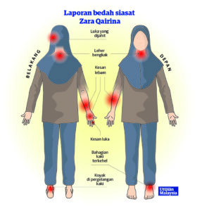 Remaja Didakwa Buli Zara Qairina Siap Buat ‘Peace’ Ketika Dipanggil Beri Keterangan, Warden Nafi Tunjuk Trauma