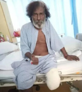 Sathiya Akhirnya Hilang Kaki Kiri, Netizen Desak Kerajaan Hulur Bantuan