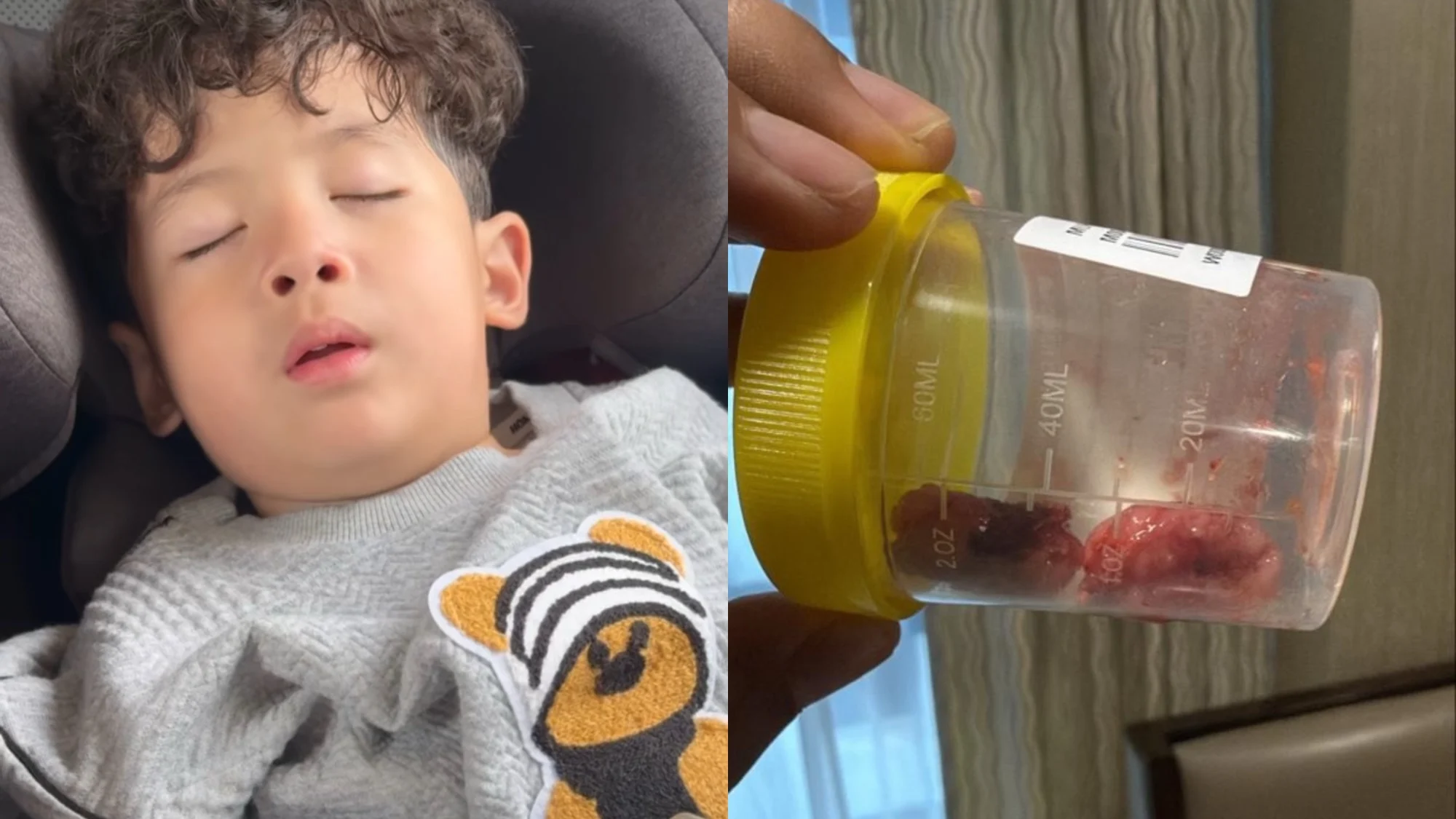 Eyra Hazali Dedah Endra Hidap Tonsil Tahap Empat-“Anak Tidur Berdengkur Tak Normal Ya..”