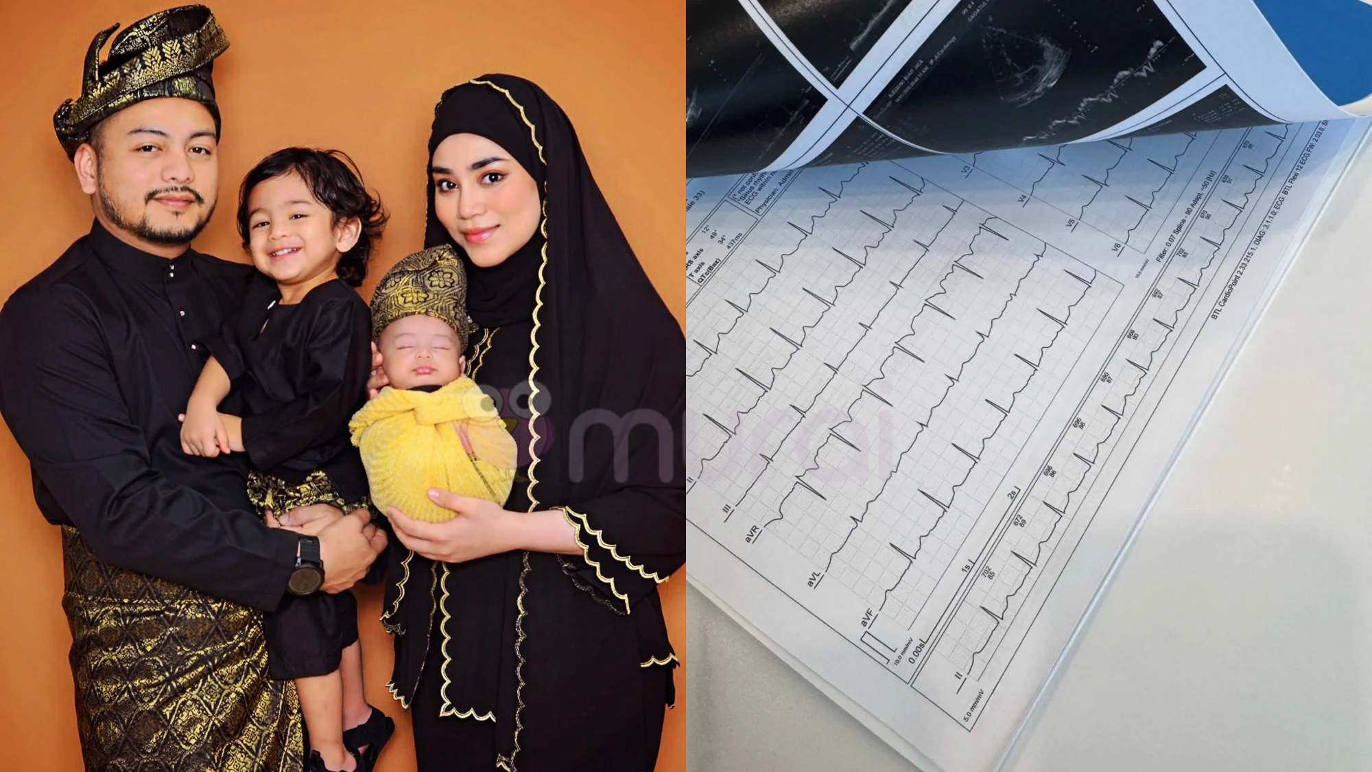 Uyaina Arshad Pernah Disahkan Tak Boleh Hamil Kerana Ambil Ubat Untuk 2 Masalah Jantung?