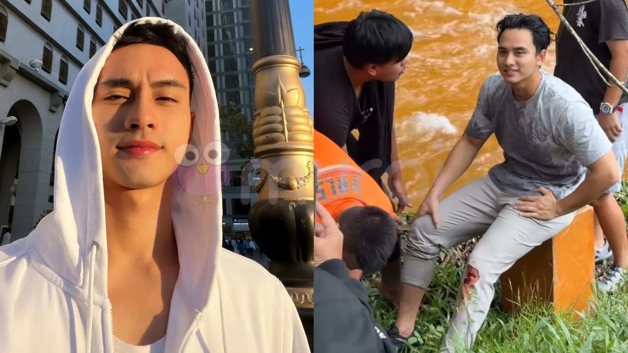 Aniq Suhair Terima 6 Jahitan Selepas Alami Kecederaan Ketika ‘Shooting’-“Malang Memang Tak Berbau..”